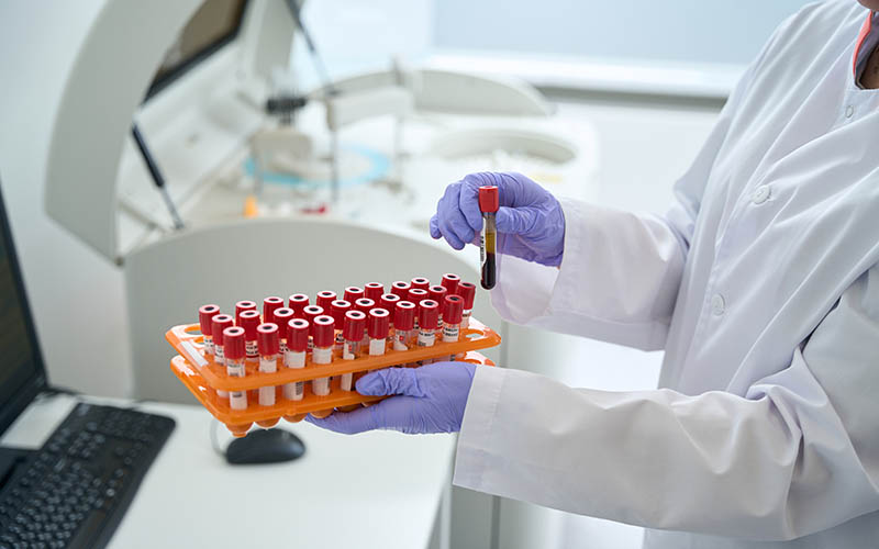 Cropped photo of female scientist working with blood samples at laboratory