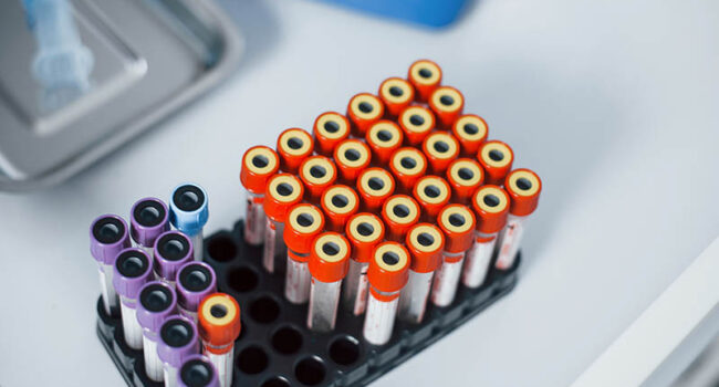 Top view of vials with medical experimental liquid that stands on white surface.